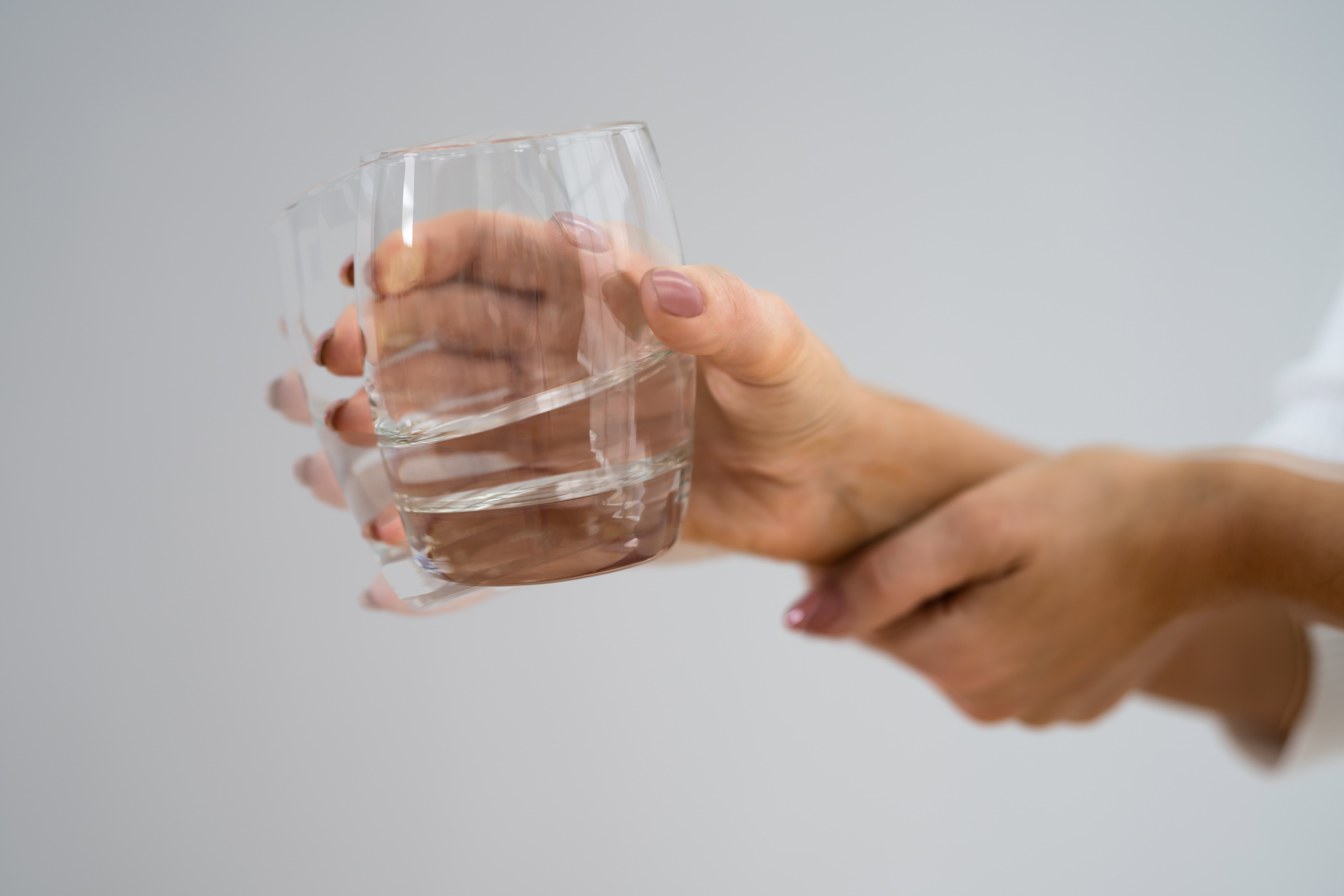 Person,Hand,With,Dystonia.,Degenerative,Aging,Movement